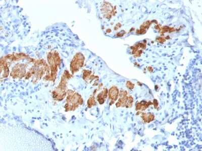 Immunohistochemistry-Paraffin: Myosin heavy chain 11 Antibody (MYH11/2303R) - Azide and BSA Free [NBP3-08486]