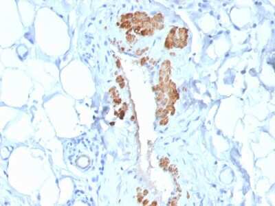 Immunohistochemistry-Paraffin: Myosin heavy chain 11 Antibody (MYH11/2303R) - Azide and BSA Free [NBP3-08486]