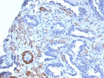 Immunohistochemistry-Paraffin: Myosin heavy chain 11 Antibody (MYH11/2303R) - Azide and BSA Free [NBP3-08486]