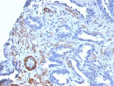 Immunohistochemistry-Paraffin: Myosin heavy chain 11 Antibody (MYH11/2303R) [NBP3-07595]