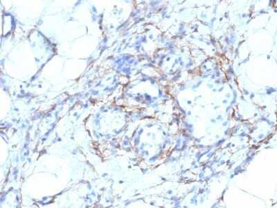Immunohistochemistry-Paraffin: Myosin heavy chain 11 Antibody (MYH11/923 + SMMS-1) - Azide and BSA Free [NBP2-47901]