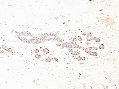 Immunohistochemistry-Paraffin: Myosin heavy chain 11 Antibody (MYH11/923 + SMMS-1) - Azide and BSA Free [NBP2-47901]