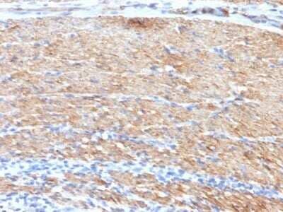 Immunohistochemistry-Paraffin: Myosin heavy chain 11 Antibody (MYH11/923 + SMMS-1) - Azide and BSA Free [NBP2-47901]