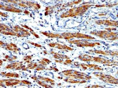 Immunohistochemistry-Paraffin: Myosin heavy chain 11 Antibody (MYH11/923 + SMMS-1) - IHC-Prediluted [NBP2-48150]