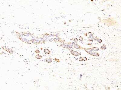 Immunohistochemistry-Paraffin: Myosin heavy chain 11 Antibody (MYH11/923 + SMMS-1) - IHC-Prediluted [NBP2-48150]