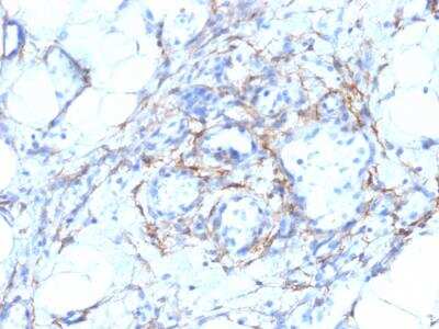 Immunohistochemistry-Paraffin: Myosin heavy chain 11 Antibody (MYH11/923 + SMMS-1) - IHC-Prediluted [NBP2-48150]