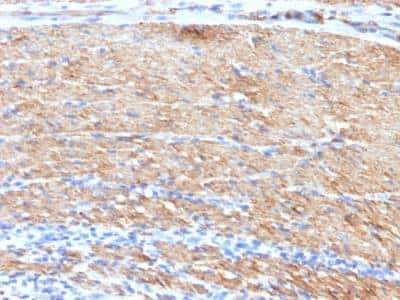 Immunohistochemistry-Paraffin: Myosin heavy chain 11 Antibody (MYH11/923 + SMMS-1) - IHC-Prediluted [NBP2-48150]