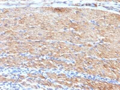 Immunohistochemistry-Paraffin: Myosin heavy chain 11 Antibody (MYH11/923 + SMMS-1) [NBP2-44534]
