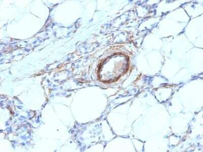 Immunohistochemistry-Paraffin: Myosin heavy chain 11 Antibody (MYH11/923) - Azide and BSA Free [NBP2-47900]