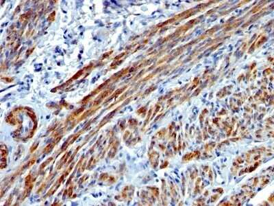 Immunohistochemistry-Paraffin: Myosin heavy chain 11 Antibody (MYH11/923) - Azide and BSA Free [NBP2-47900]