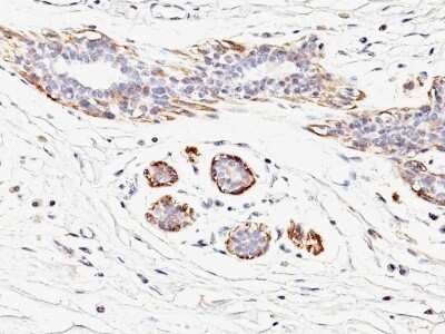 Immunohistochemistry-Paraffin: Myosin heavy chain 11 Antibody (MYH11/923) - Azide and BSA Free [NBP2-47900]