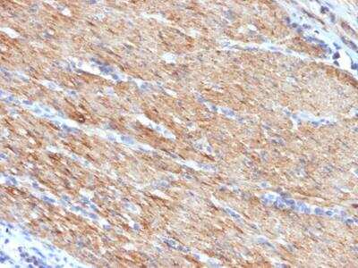 Immunohistochemistry-Paraffin: Myosin heavy chain 11 Antibody (MYH11/923) - IHC-Prediluted [NBP2-48149]