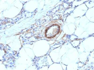 Immunohistochemistry-Paraffin: Myosin heavy chain 11 Antibody (MYH11/923) [NBP2-44533]
