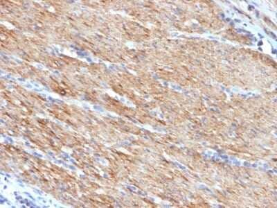 Immunohistochemistry-Paraffin: Myosin heavy chain 11 Antibody (MYH11/923) [NBP2-44533]