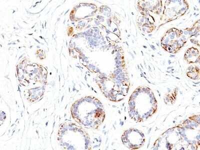 Immunohistochemistry-Paraffin: Myosin heavy chain 11 Antibody (SMMS-1) - Azide and BSA Free [NBP2-47898]