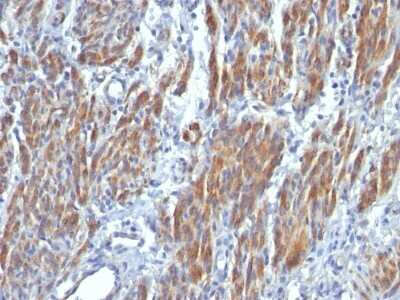 Immunohistochemistry-Paraffin: Myosin heavy chain 11 Antibody (SMMS-1) - Azide and BSA Free [NBP2-47898]