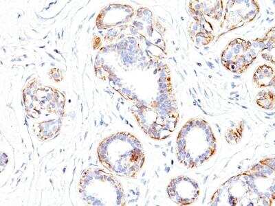Immunohistochemistry-Paraffin: Myosin heavy chain 11 Antibody (SMMS-1) - IHC-Prediluted [NBP2-48443]