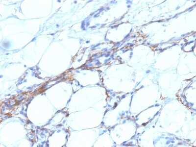 Immunohistochemistry-Paraffin: Myosin heavy chain 11 Antibody (SPM201) [NBP2-44531]