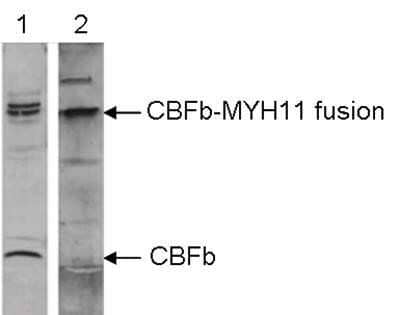 Western Blot: Myosin heavy chain 11 Antibody [NBP2-59221]