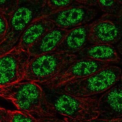 Immunocytochemistry/ Immunofluorescence: Myosin heavy chain 14 Antibody [NBP2-56586]