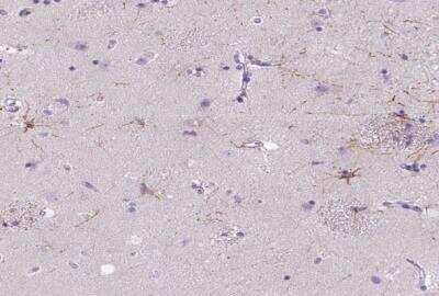 Immunohistochemistry-Paraffin: Myosin heavy chain 15 Antibody [NBP1-87894]