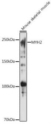 Western Blot: Myosin heavy chain 2 AntibodyAzide and BSA Free [NBP2-94624]