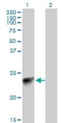 Western Blot: Myosin light chain 3 Antibody (4C2) [H00004634-M12]