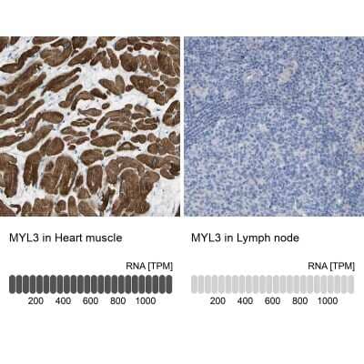 Immunohistochemistry-Paraffin: Myosin light chain 3 Antibody [NBP1-88068]