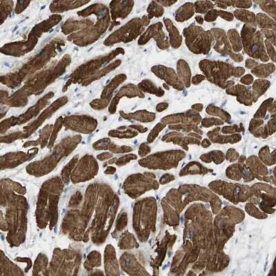 Immunohistochemistry-Paraffin: Myosin light chain 3 Antibody [NBP1-88068]