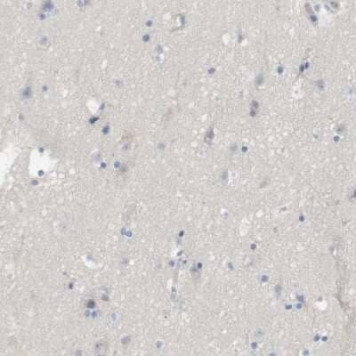 Immunohistochemistry-Paraffin: Myosin light chain 3 Antibody [NBP1-88068]