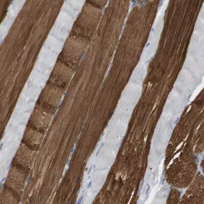 Immunohistochemistry-Paraffin: Myosin light chain 3 Antibody [NBP1-88068]