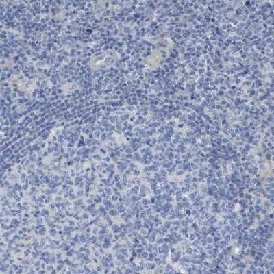 Immunohistochemistry-Paraffin: Myosin light chain 3 Antibody [NBP1-88068]