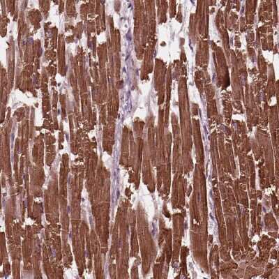 Immunohistochemistry-Paraffin: Myosin light chain 3 Antibody [NBP2-57186]