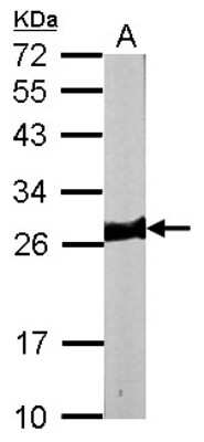Western Blot: Myosin light chain 3 Antibody [NBP1-33303]