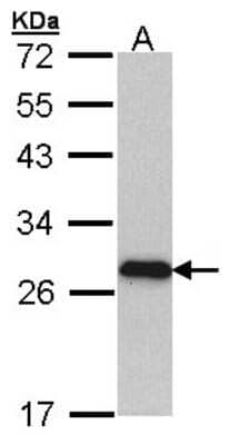 Western Blot: Myosin light chain 3 Antibody [NBP1-33303]