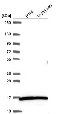 Western Blot: Myosin light chain 3 Antibody [NBP2-57186]