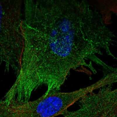 Immunocytochemistry/ Immunofluorescence: Myosin light chain kinase Antibody [NBP2-68679]