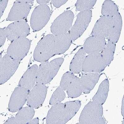Immunohistochemistry-Paraffin: Myosin light chain kinase Antibody [NBP1-87744]