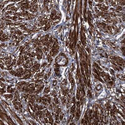 Immunohistochemistry-Paraffin: Myosin light chain kinase Antibody [NBP1-87744]