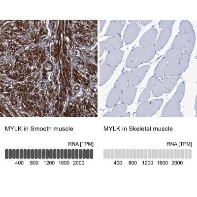 Immunohistochemistry-Paraffin: Myosin light chain kinase Antibody [NBP1-87744]