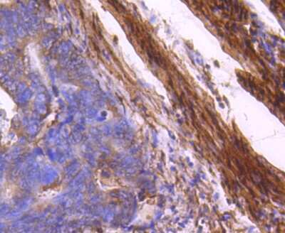 Immunohistochemistry-Paraffin: Myosin light chain kinase Antibody (SU40-06) [NBP2-67486]