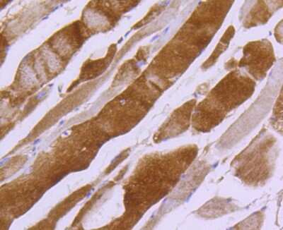 Immunohistochemistry-Paraffin: Myosin light chain kinase Antibody (SU40-06) [NBP2-67486]
