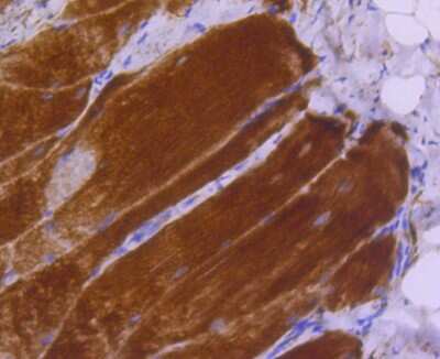 Immunohistochemistry-Paraffin: Myosin light chain kinase Antibody (SU40-06) [NBP2-67486]
