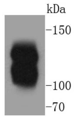 Western Blot: Myosin light chain kinase Antibody (SU40-06) [NBP2-67486]