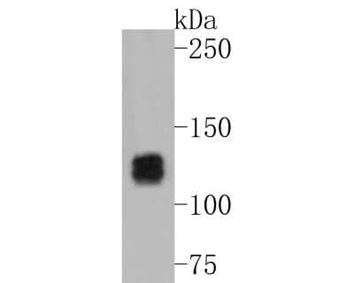 Western Blot: Myosin light chain kinase Antibody (SU40-06) [NBP2-67486]