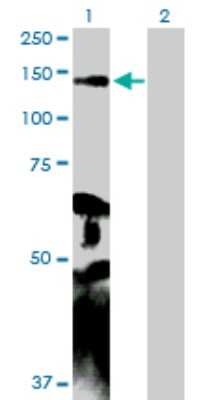 Western Blot: Myosin light chain kinase Antibody [H00004638-D01P]
