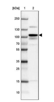 Western Blot: Myosin light chain kinase Antibody [NBP1-87744]