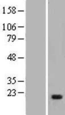 Western Blot: Myosin light chain kinase Overexpression Lysate [NBP2-05825]
