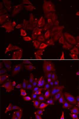 Immunocytochemistry/ Immunofluorescence: Myotilin Antibody - BSA Free [NBP2-94022]