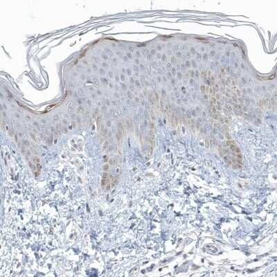 Immunohistochemistry-Paraffin: Myotilin Antibody [NBP1-87851]